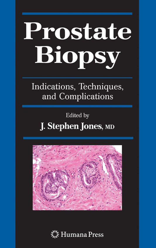 PROSTATE BIOPSY 1ST/2008 - STEPHEN JONES