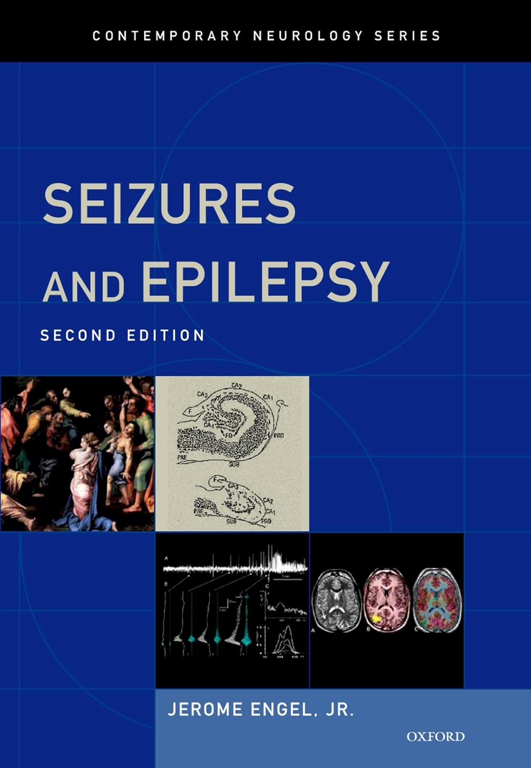 SEIZURES AND EPILEPSY 2ND/2013 - JEROME ENGEL