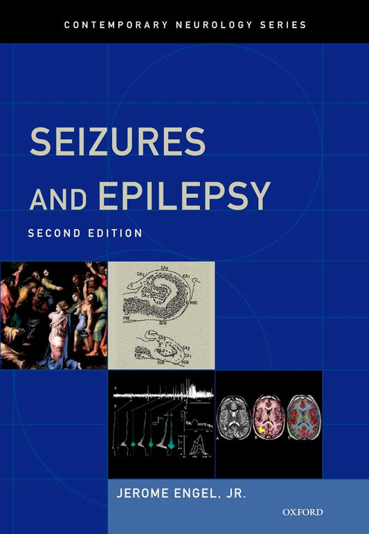 SEIZURES AND EPILEPSY 2ND/2013 - JEROME ENGEL