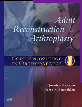 CORE KNOWLEDGE IN ORTHOPAEDICS: ADULT RECONSTRUCTION AND ARTHROPLASTY 1ST/2007-GARINO JONATHN