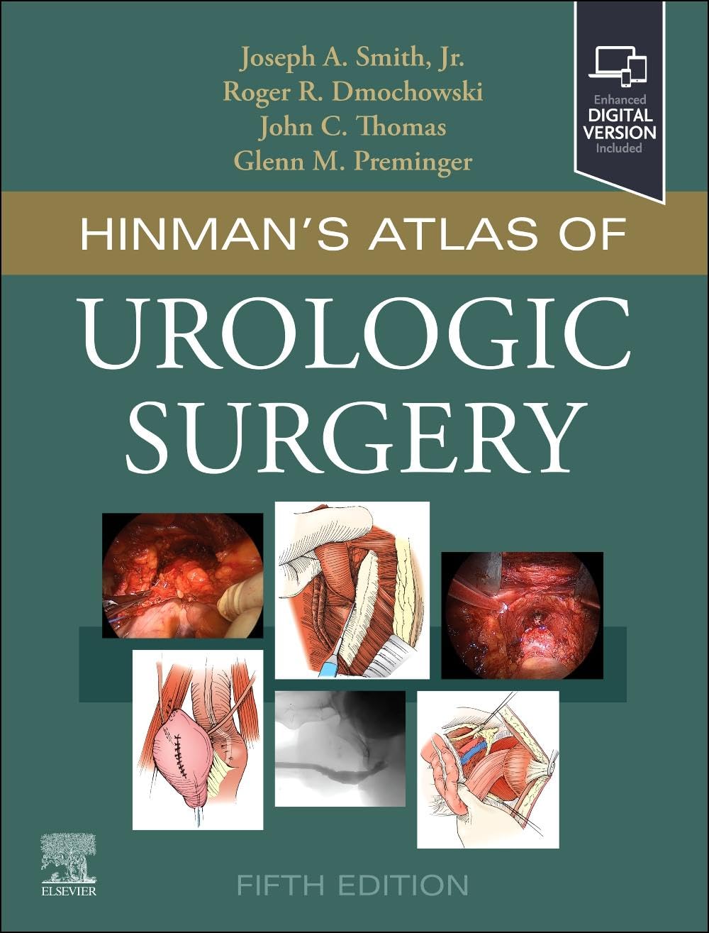 HINMANS ATLAS OF UROLOGIC SURGERY 5TH/2026