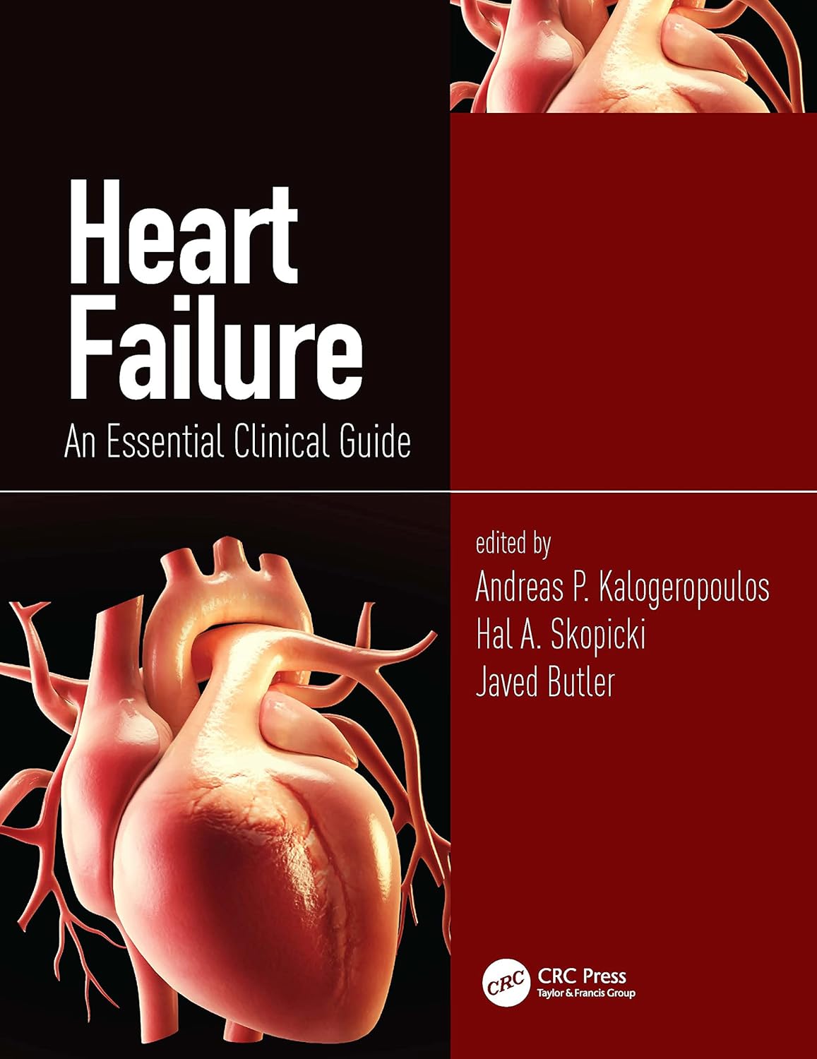 HEART FAILURE AN ESSENTIAL CLINICAL GUIDE 1ST/2022-ANDREAS KALOGEROPOULOS