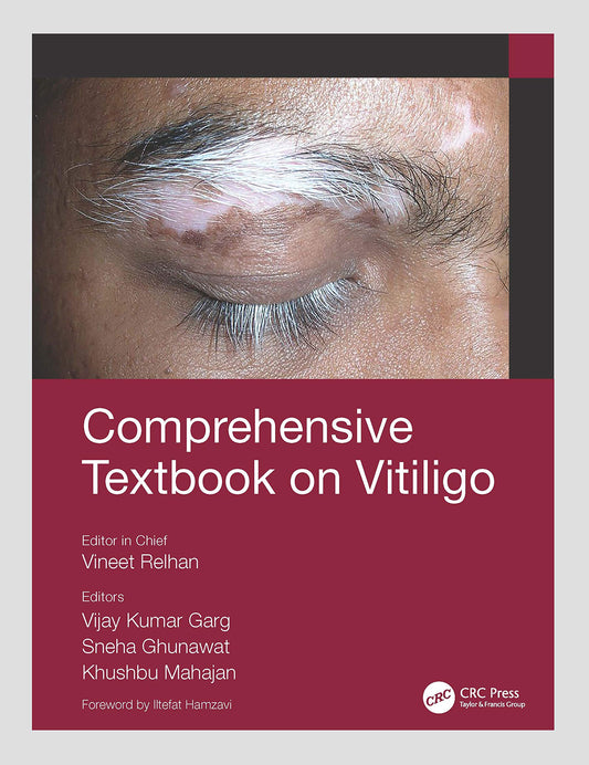 COMPREHENSIVE TEXTBOOK OF VITILIGO 1ST/2021 VINEET RELHAN (selected chapters)