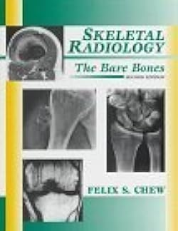 SKELETAL RADIOLOGY THE BARE BONES 1ST/1996 - FELIX CHEW
