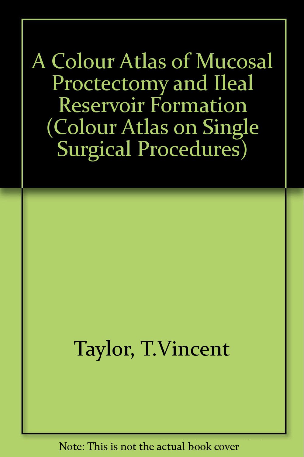 A COLOUR ATLAS OF MUCOSAL PROCTECTOMY AND ILEAL RESERVOIR FORMATION 1ST/1986 - VINCENT TAYLOR