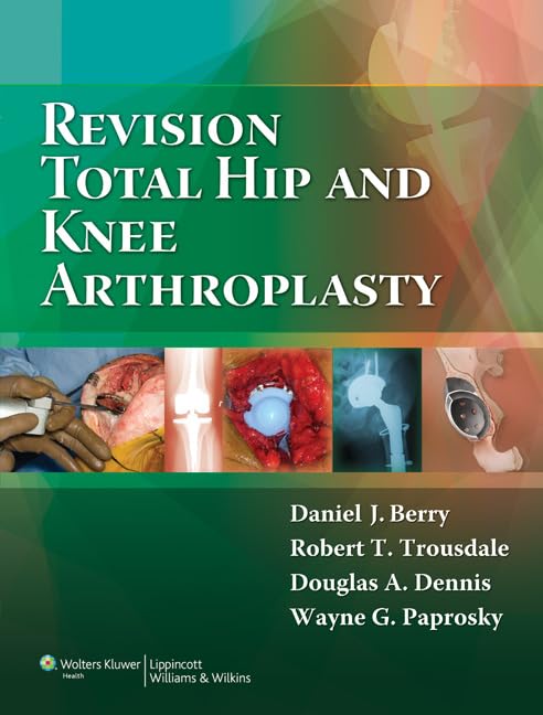 REVISION TOTAL HIP AND KNEE ARTHROPLASTY 1ST/2012-DANIEL BERRY