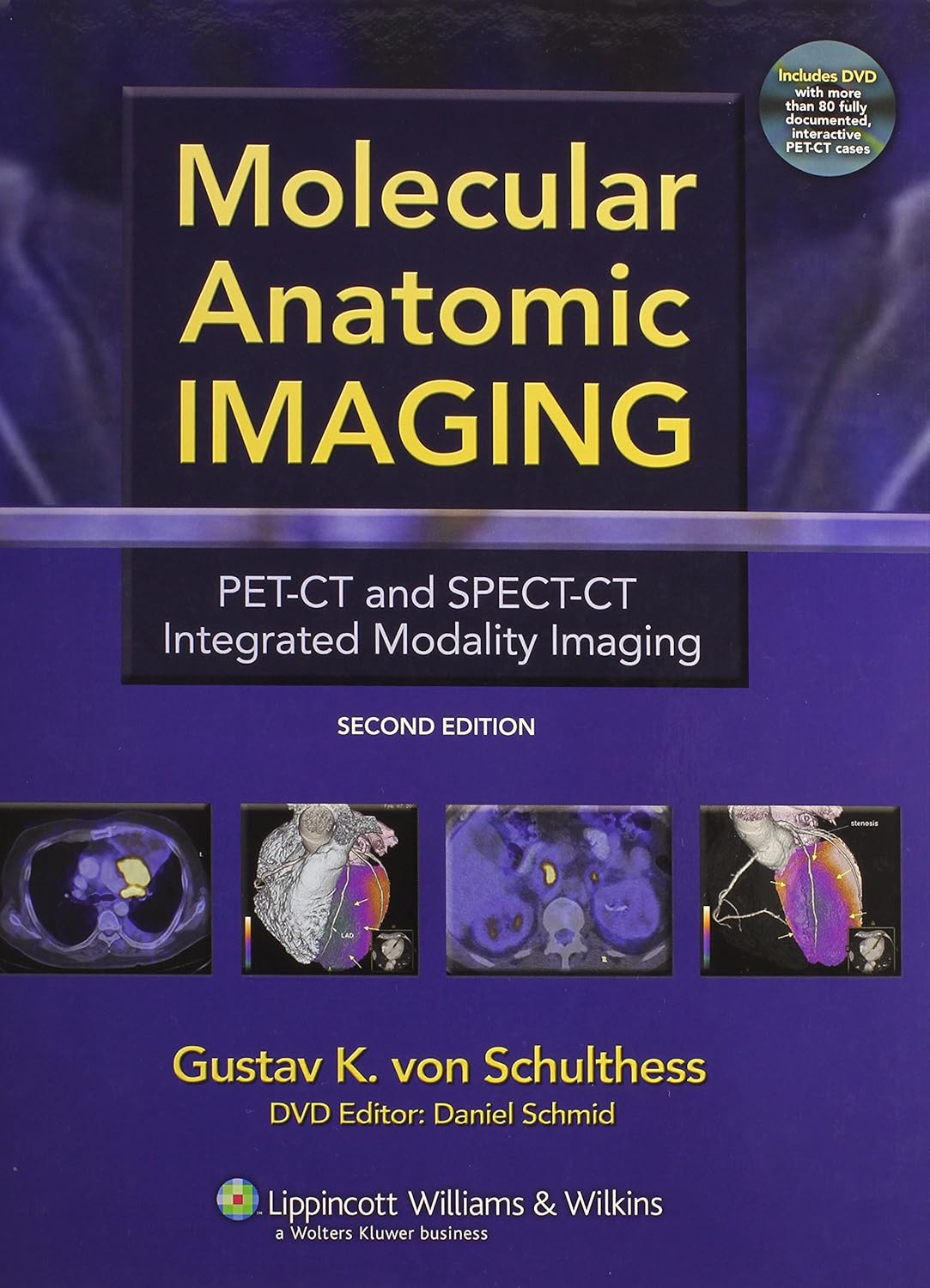MOLECULAR ANOTIMC IMAGING 1ST/2006 - GUSTAV VON SCHULTNESS