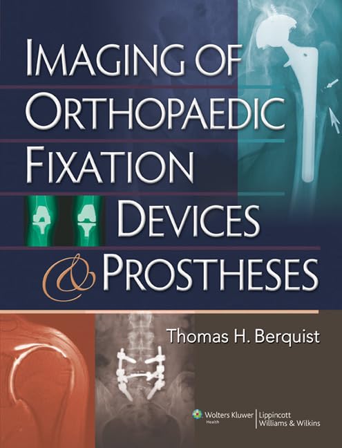 IMAGING OF ORTHOPAEDIC FIXATION DEVICES AND PROSTHESES 1ST/2008 - THOMAS BERQUIST