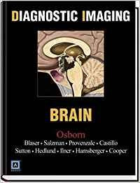 DIAGNOSTIC IMAGING -BRAIN 1ST - OSBORN