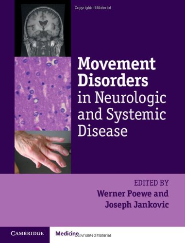 MOVEMENT DISORDERS IN NEUROLOGIC AND SYSTEMIC DISEASE 1ST/2014-WERNER POEWE