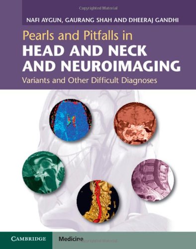 Pearls and Pitfalls in Head and Neck and Neuroimaging 1ST/2013-NAFI AYGUN