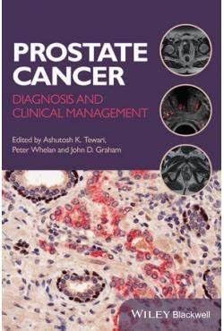 PROSTATE CANCER DIAGNOSIS AND CLINICAL MANAGEMENT 1ST/2014 -  ASHUTOSH TEWARI