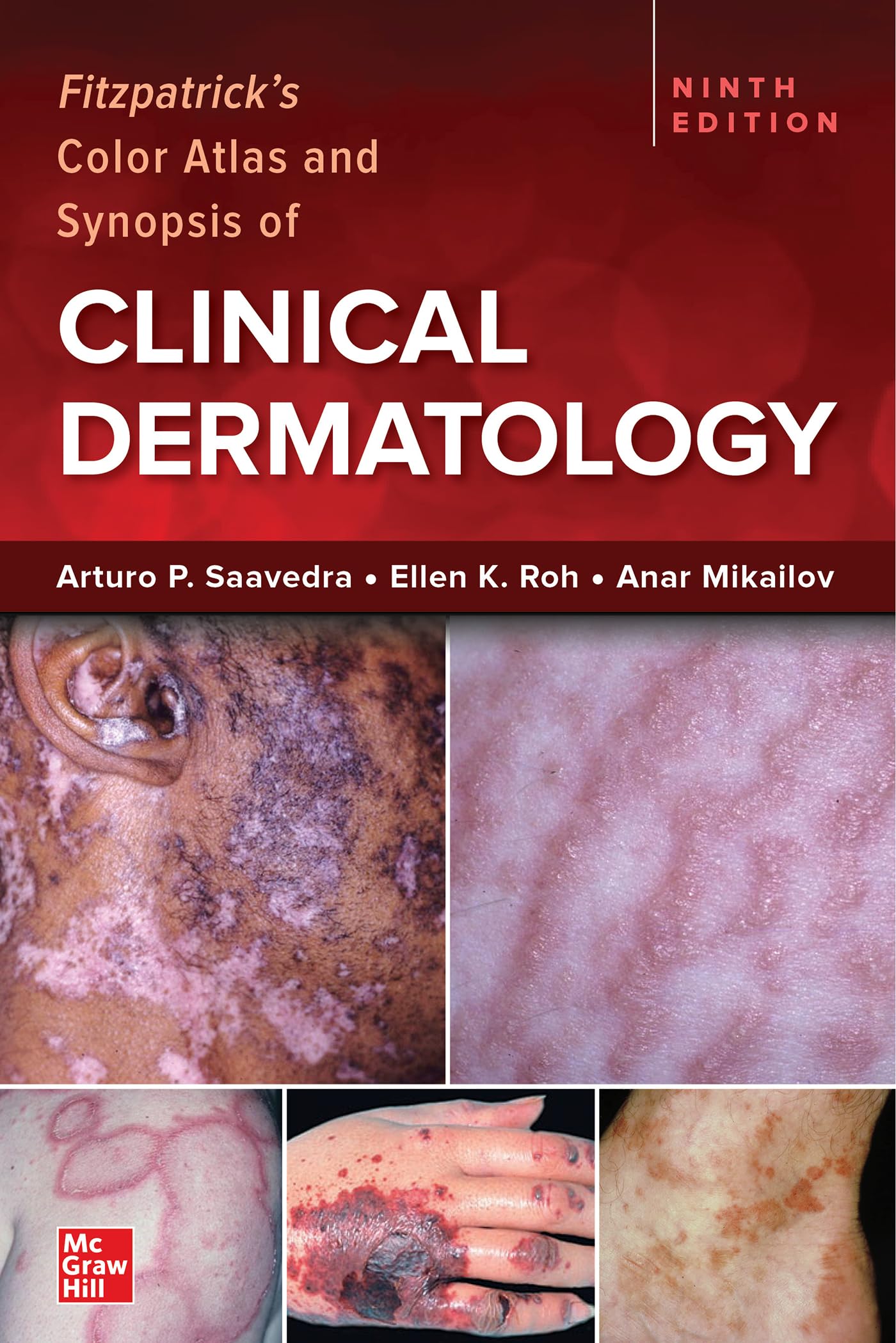 FITZPATRICK'S COLOR ATLAS AND SYNOPSIS OF CLINICAL DERMATOLOGY 9TH/2023 - ARTURO SAAVEDRA