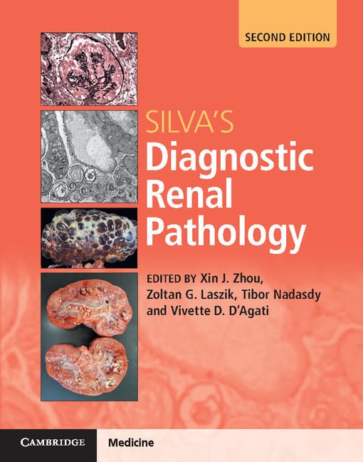 SILVAS DIAGNOSIS RENAL PATHOLOGY 2ND/2017 - XIN ZHOU