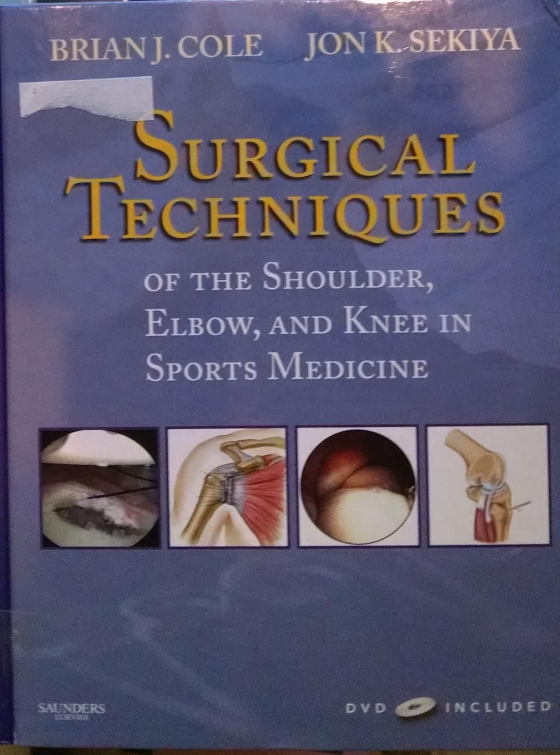 SURGICAL TECHNIQUES OF THE SHOULDER, ELBOW, AND KNEE IN SPORTS MEDICINE 1ST/2007-BRIAN COLE