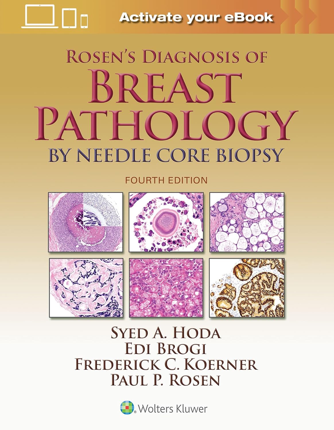 ROSEN'S DIAGNOSIS OF BREAST PATHOLOGY BY NEEDLE CORE BIOPSY 4TH/2017 - SYED HODA