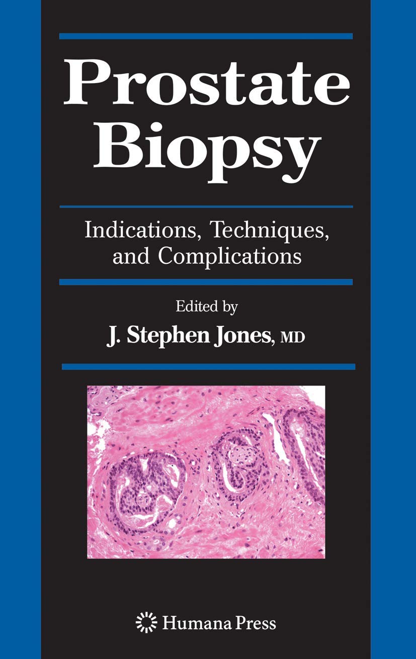 PROSTATE BIOPSY 1ST/2008 - STEPHEN JONES