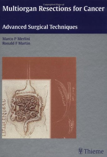 MULTIORGAN RESECTIONS FOR CANCER: ADVANCED SURGICAL TECHNIQUES 1ST/2006 - RONALD MARTIN
