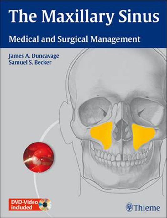 THE MAXILLARY SINUS MEDICAL AND SURGICAL MANAGEMENT VOLUME -2 1ST/2011 JAMES DUNCAVAGE