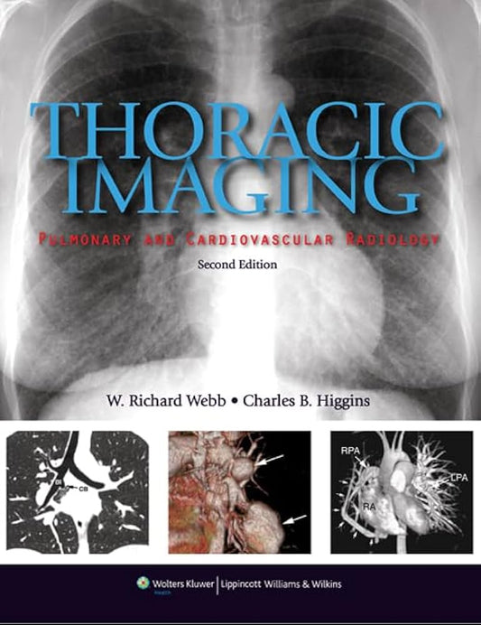 THORACIC IMAGING : PULMONARY AND CARDIOVASCULAR RADIOLOGY 2ND/2016 - RICHARD WEBB (PRE OWNED)