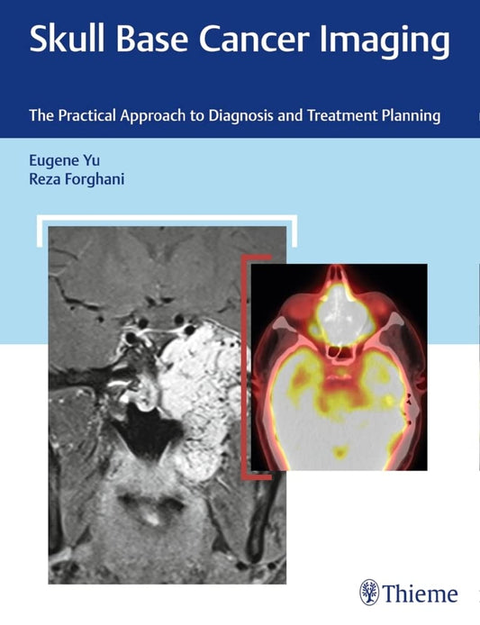 SKULL BASE CANCER IMAGING: THE PRACTICAL APPROACH TO DIAGNOSIS AND TREATMENT PLANNING 1ST/2017 - EUGENE YU