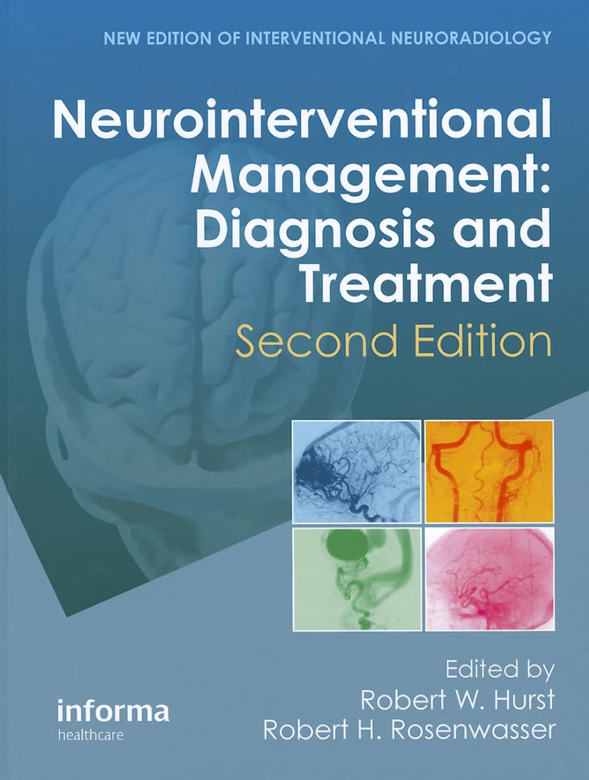 NEUROINTERVENTIONAL MANAGEMENT- DIAGNOSIS AND TREATMENT 2ND/2012 - ROBERT HURST