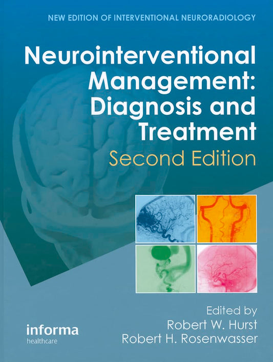 NEUROINTERVENTIONAL MANAGEMENT- DIAGNOSIS AND TREATMENT 2ND/2012 - ROBERT HURST