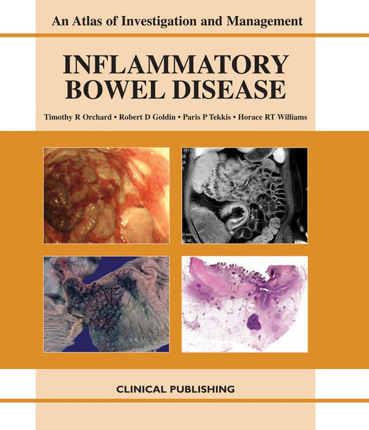 AN ATLAS INVESTIGATION AND MANAGEMENT INFLAMMATORY BOWEL DISEASE 1ST/2011 - TIMOTHY ORCHARD