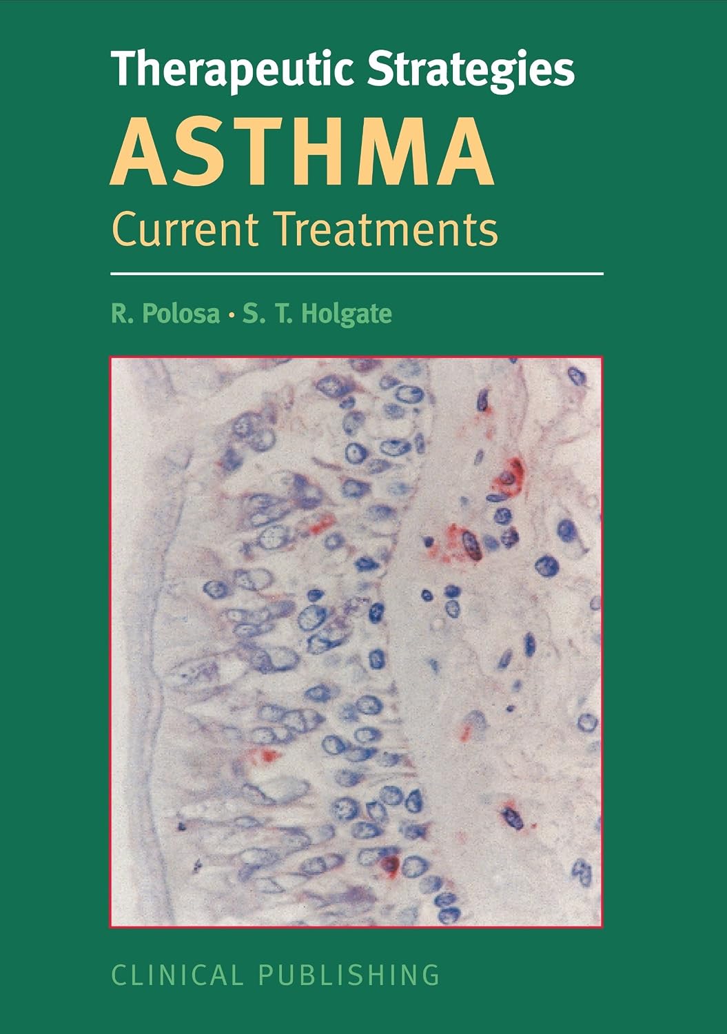 THERAPEUTIC STRATEGIES ASTHMA CURRENT TREATMENTS 1ST/2007-POLOSA