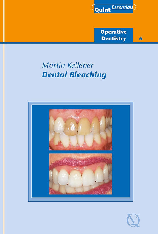 DENTAL BLEECHING 1ST/2007 - MARTIN KELLEHER