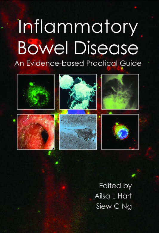 INFLAMMATORY BOWEL DISEASE AN EVIDENCE BASED PRACTICAL GUIDE 1ST/2012 - AILSA HART