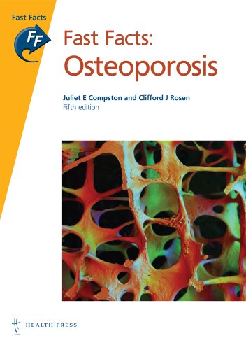 FAST FACTS: OSTEOPOROSIS 1ST/2006 - JULIET COMPSTON