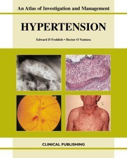 AN ATLAS OF INVESTIGATION AND MANAGEMENT HYPERTENSION 1ST/2009 - EDWARD FROHLICH