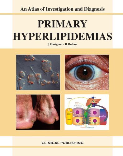 AN ATLAS OF INVESTIGATION AND DIAGNOSIS PRIMARY HYPERLIPIDEMIAS 1ST/2007 J DAVIGNON