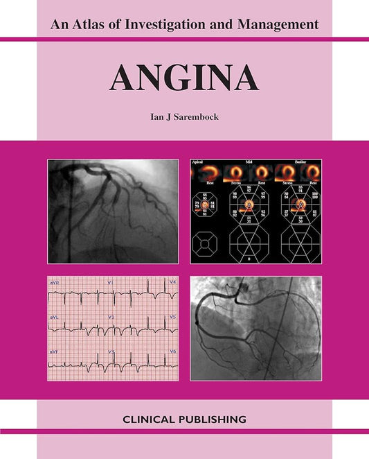 AN ATLAS OF INVESTIGATION AND MANAGEMENT ANGINA 1ST/2007 - IAN SAREMBOCK
