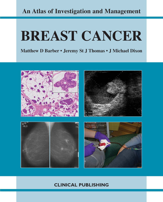AN ATLAS OF INVESTIGATION AND MANAGEMENT BREAST CANCER 1ST/2008 - MATTHEW BARBER