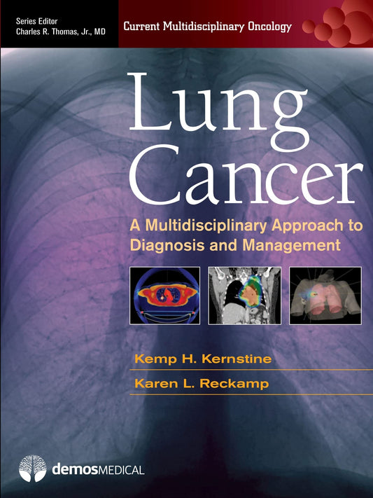 LUNG CANCER: A MULTIDISCIPLINARY APPROACH TO DIAGNOSIS AND MANAGEMENT 1ST/2010 - KEMP KERSTINE
