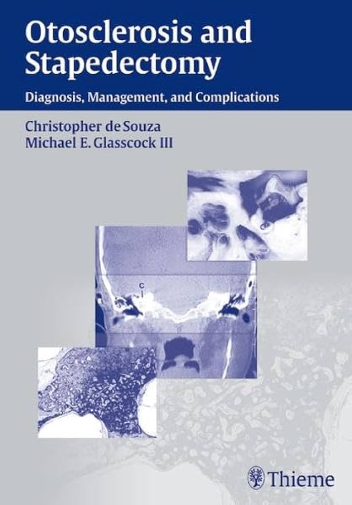 OTOSCLEROSIS AND STAPEDECTOMY DIAGNOSIS MANAGEMENT AND COMPLICATIONS 1ST/2004 CHRISTOPHER SOUZA