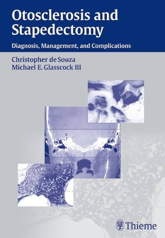 OTOSCLEROSIS AND STAPEDECTOMY DIAGNOSIS MANAGEMENT AND COMPLICATIONS 1ST/2004 CHRISTOPHER SOUZA