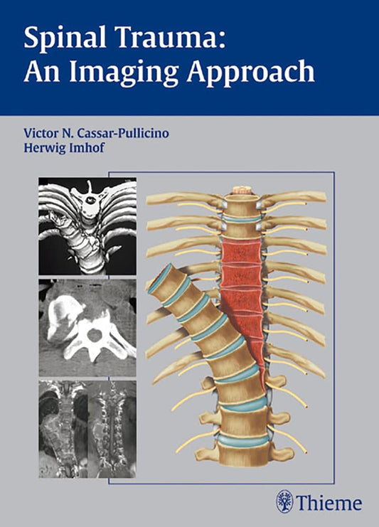 SPINAL TRAUMA AN IMAGING APPROACH 1ST/2006-VICTOR CASSAR