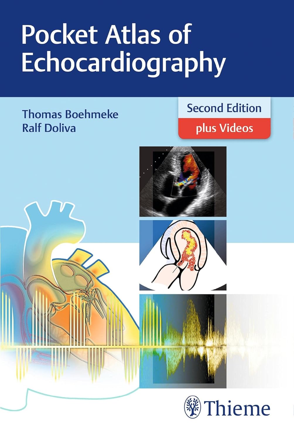 POCKET ATLAS OF ECHOCARDIOGRAPHY 2ND/2017 - THOMAS