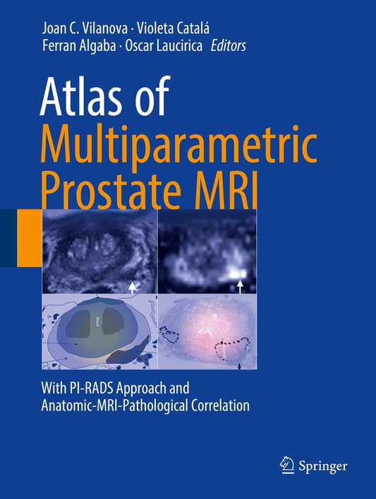 ATLAS OF MULTIPARAMETRIC PROSTATE MRI: WITH PI-RADS APPROACH AND ANATOMIC-MRI-PATHOLOGICAL CORRELATION 1ST/2017 -  JOAN C. VILANOVA