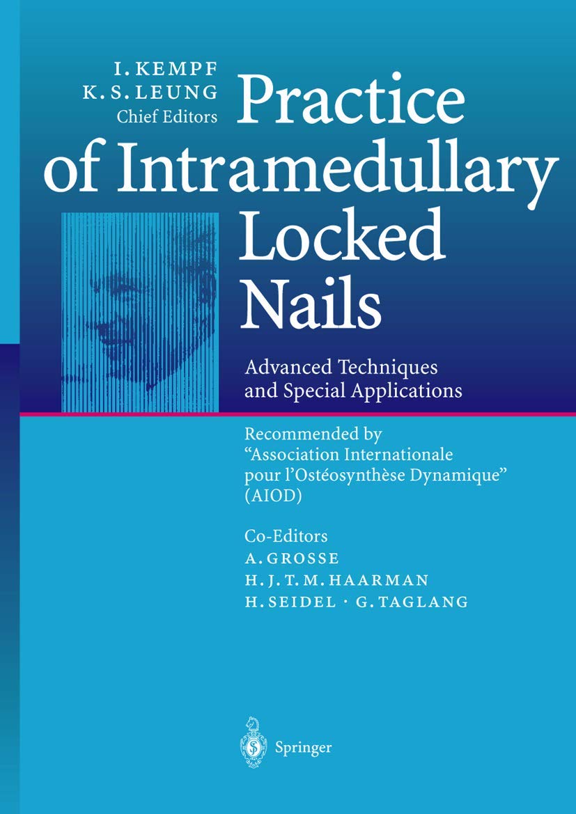 Practice of Intramedullary Locked Nails 1ST/2012 - KEMPF
