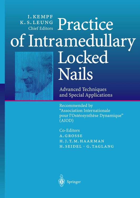 Practice of Intramedullary Locked Nails 1ST/2012 - KEMPF