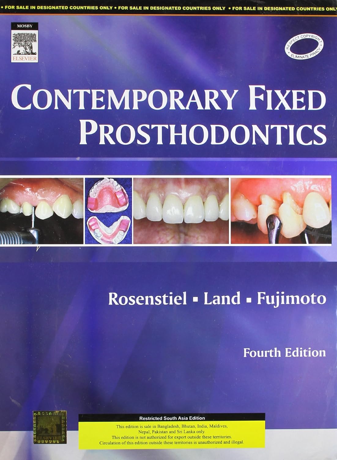 CONTEMPORARY FIXED PROSTHODONTICS 4TH/2006 - STEPHEN F. ROSENSTIEL