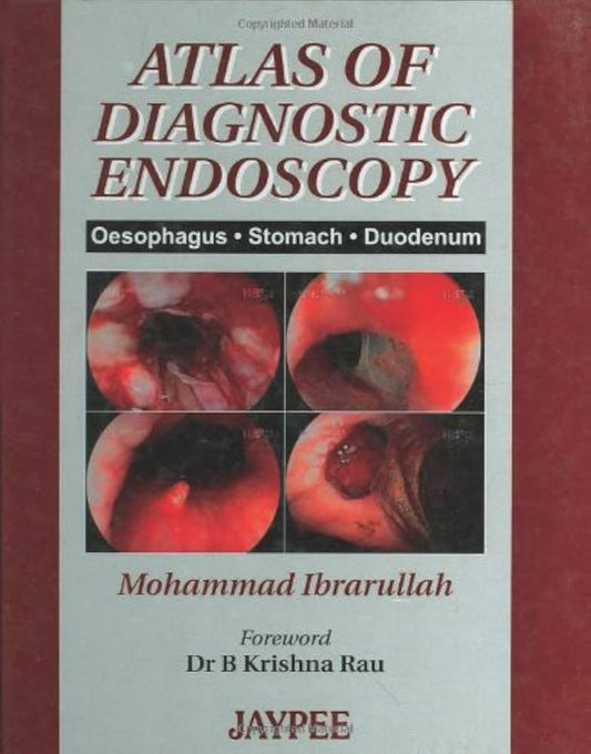 ATLAS OF DIAGNOSTIC ENDOSCOPY OESOPHAGUS STOMACH DUODENUM 1ST/2004 - MOHAMMAD IBRARHULLAH