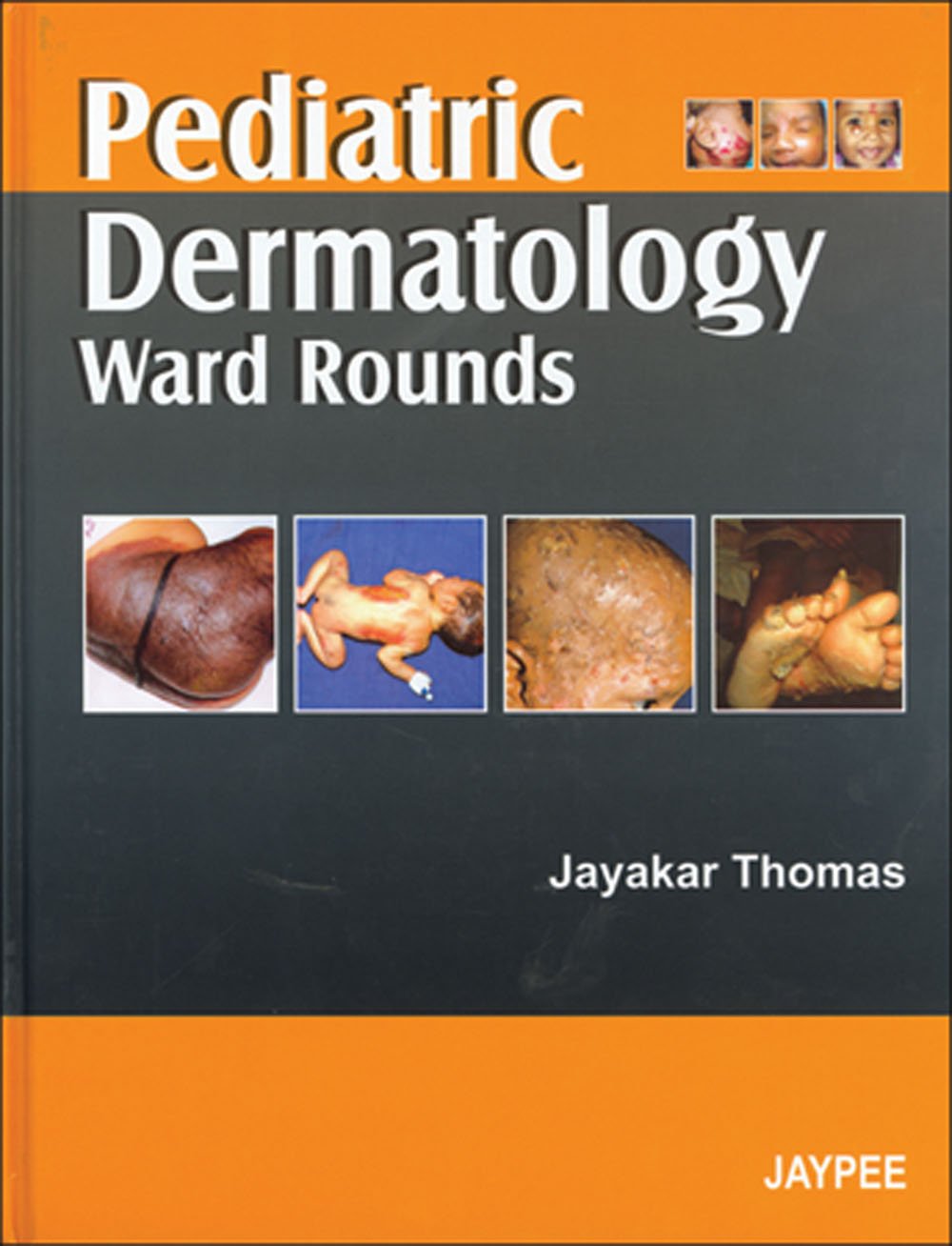 PEDIATRIC DERMATOLOGY WARD ROUNDS 1ST/2007 - JAYKAR THOMAS