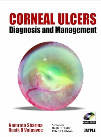CORNEAL ULCERS DIAGNOSIS AND MANAGEMENT 1ST/2008 NAMRATA SHARMA(USED)
