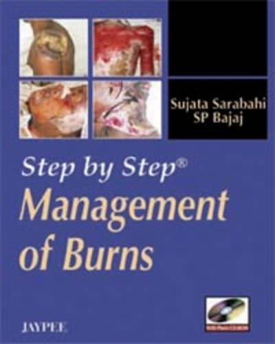 STEP BY STEP MANAGEMENT OF BURNS 1ST/2008  - SUJATA SARABAHI