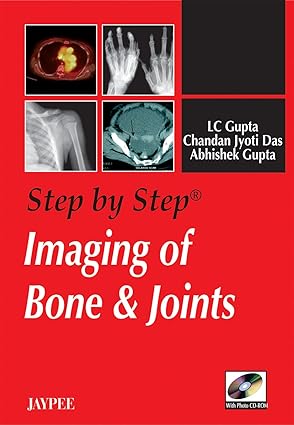STEP BY STEP IMAGING OF BONE & JOINTS WITH PHOTO CD-ROM, 1ST/2008 - LC GUPTA